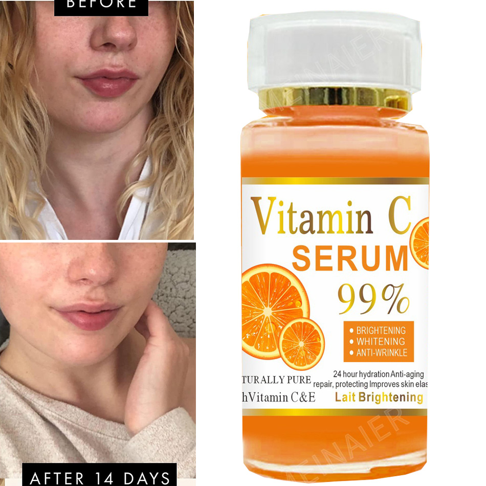 Vitamin C Serum - Super 120Ml Vitamine C Serum Anti-Aging