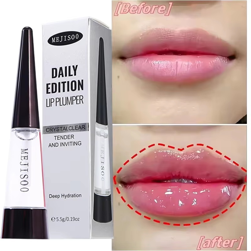 Snelwerkende Lippenbalsem voor - Lip Balm recensie en prijs