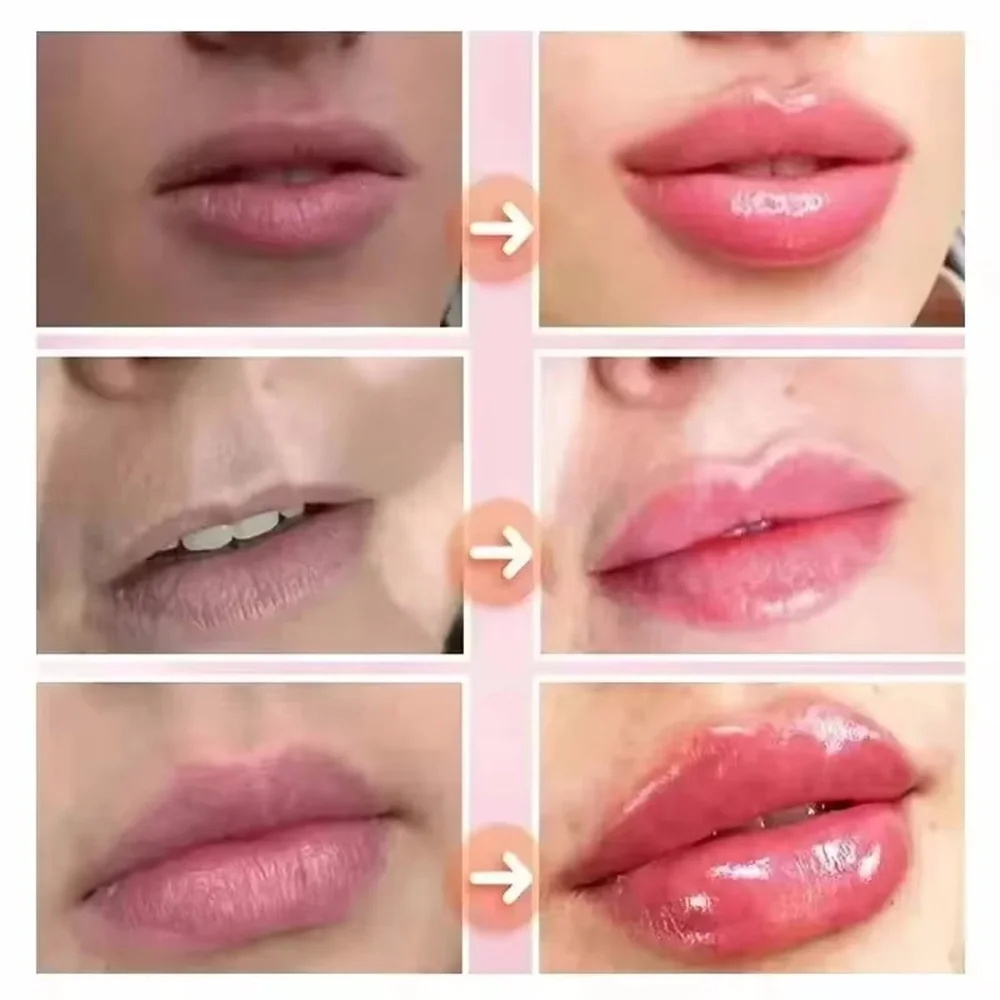 Snelwerkende Lippenbalsem voor - Lip Balm recensie en prijs