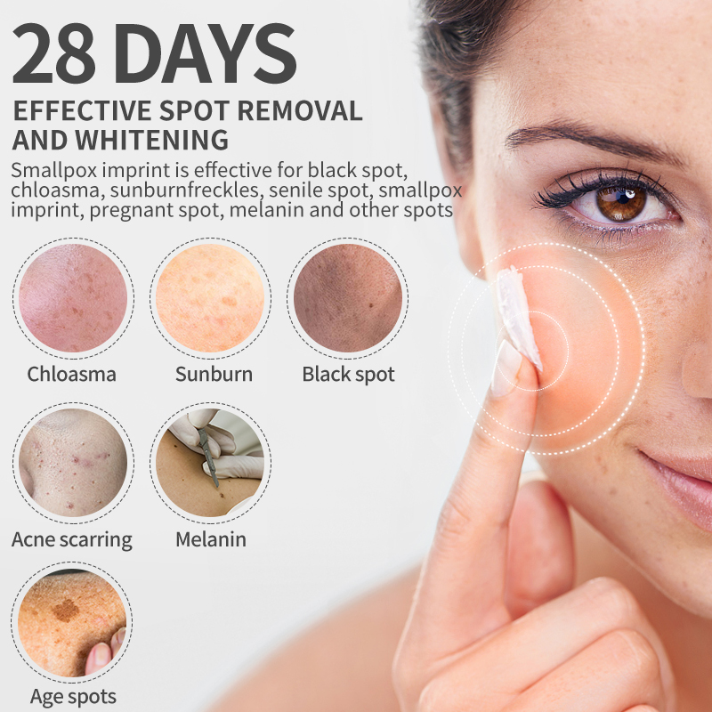 Dimollaure Whitening Sproet Cr - Night Cream recensie en prijs