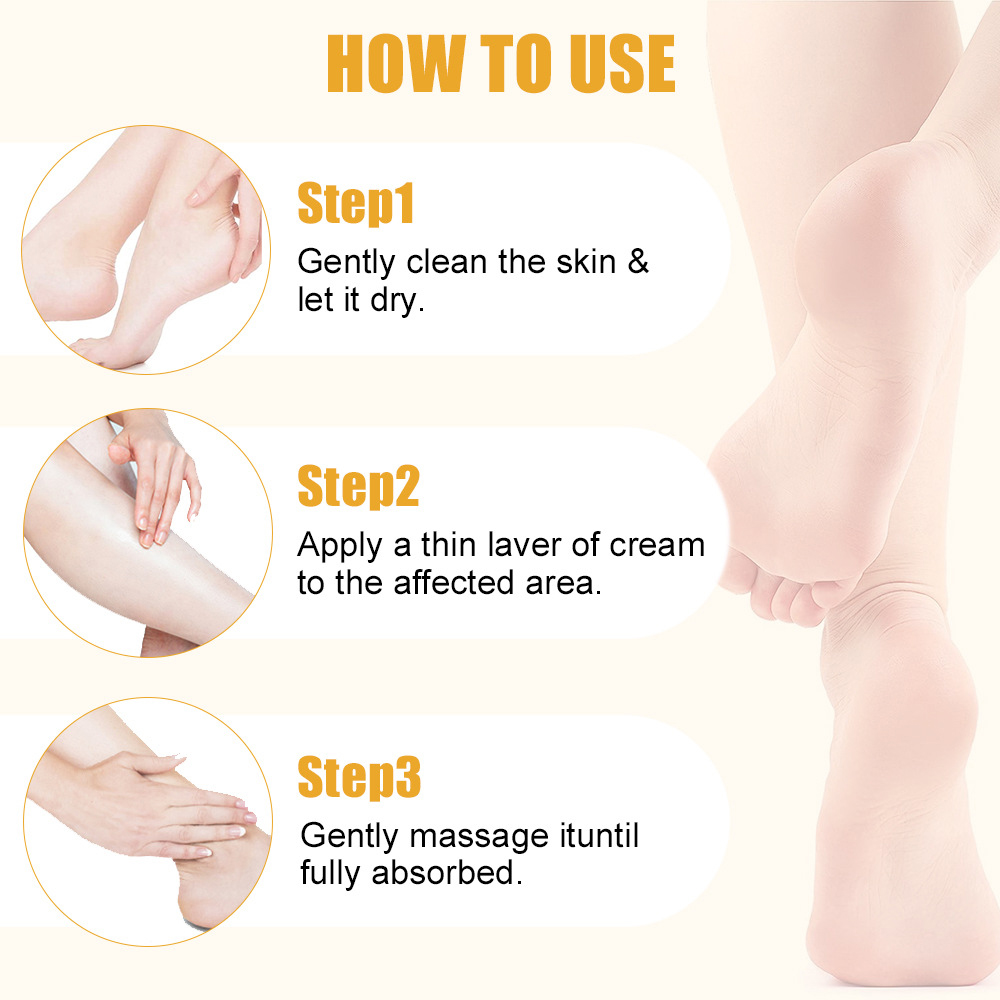 Ureumcrème 60% salicylzuur 2%  - Urea Foot Cream recensie en prijs