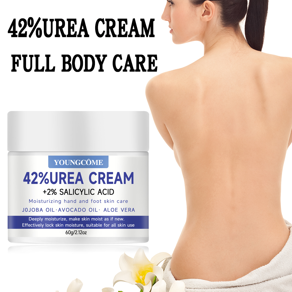 YOUNGCOME 42% ureumcrème +2% s - Urea Foot Cream recensie en prijs