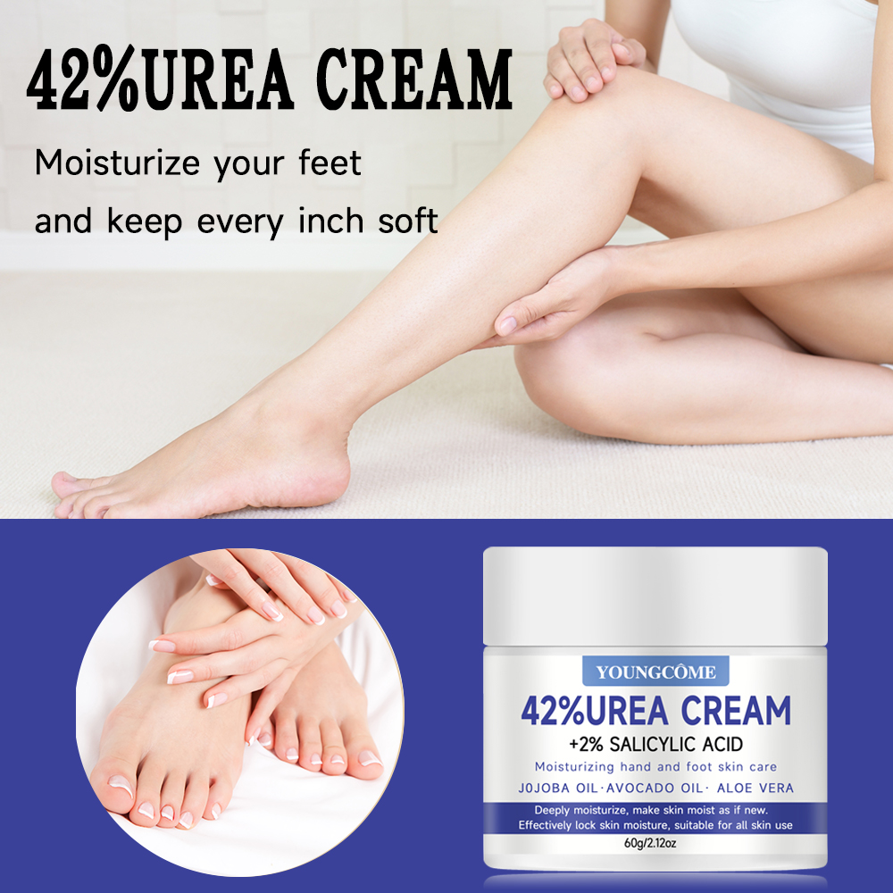 YOUNGCOME 42% ureumcrème +2% s - Urea Foot Cream recensie en prijs