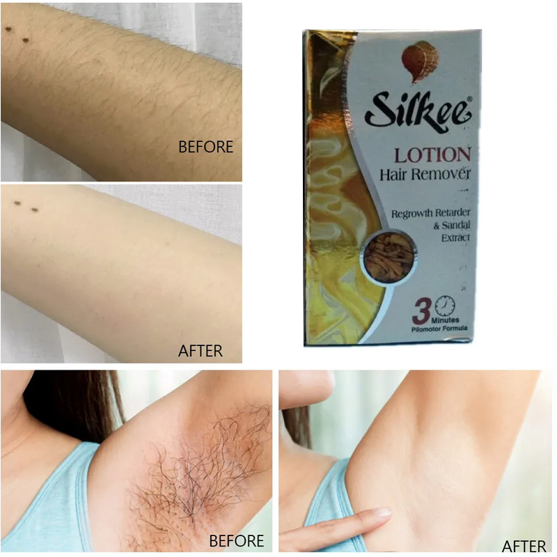SILKEE CM Ontharingslotion 1 f - Body Lotion recensie en prijs