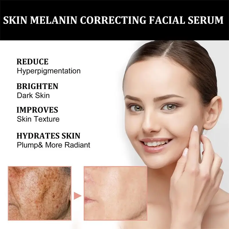 Melanine Facial Repair Serum 3 - Vitamin C Serum recensie en prijs