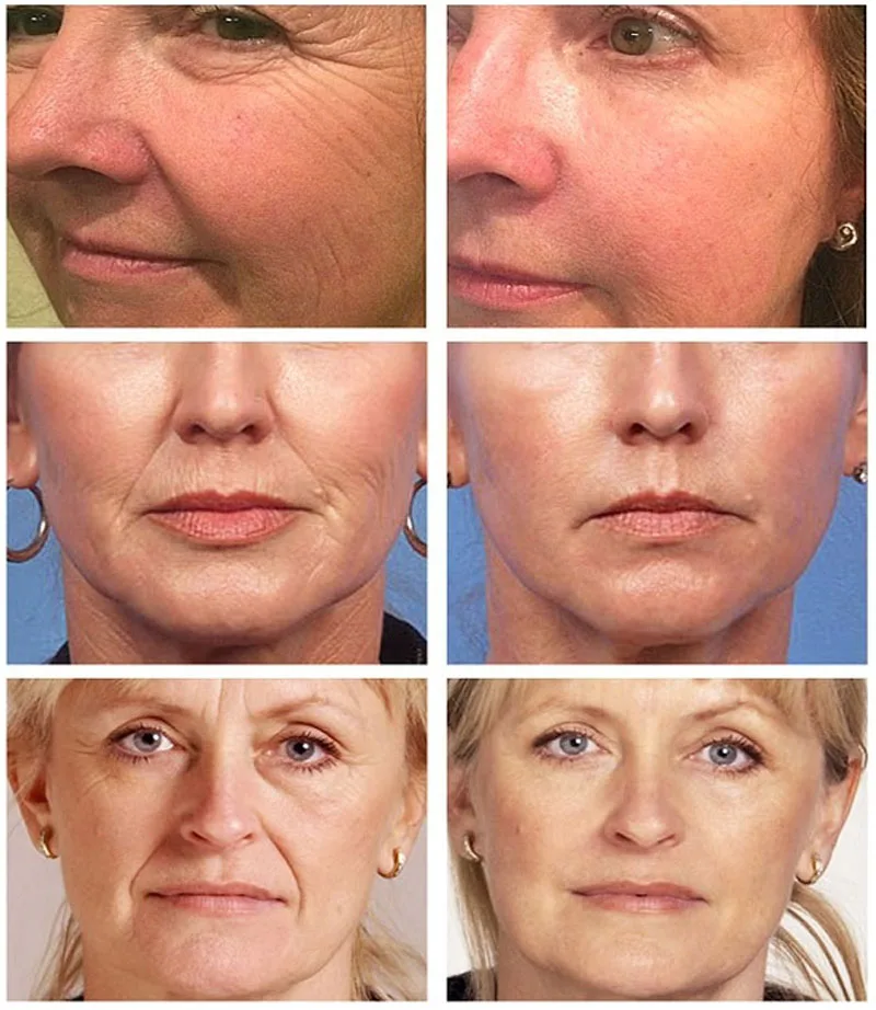 Collageen Rimpel Remover Gezic - Vitamin C Serum recensie en prijs
