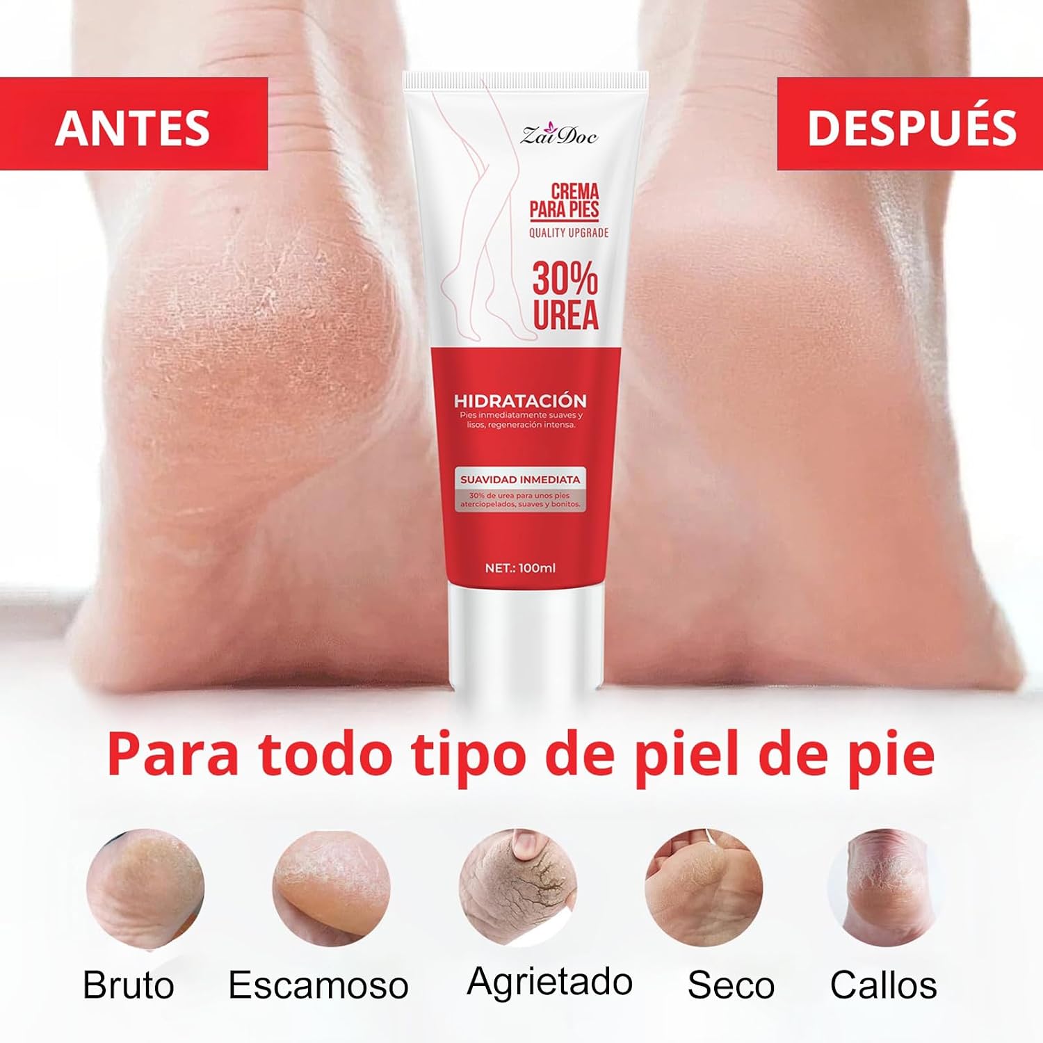 ZaiDoc 2/4 stuks Ureum Voetcrè - Urea Foot Cream recensie en prijs