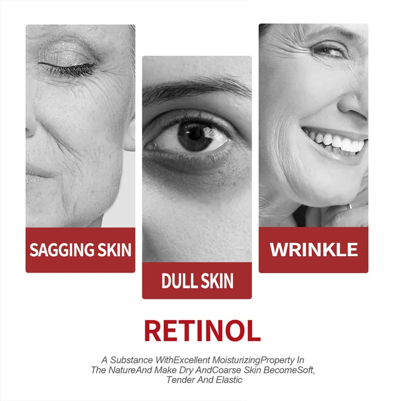 Retinol Crème Hydraterende Hui - Retinol Cream recensie en prijs