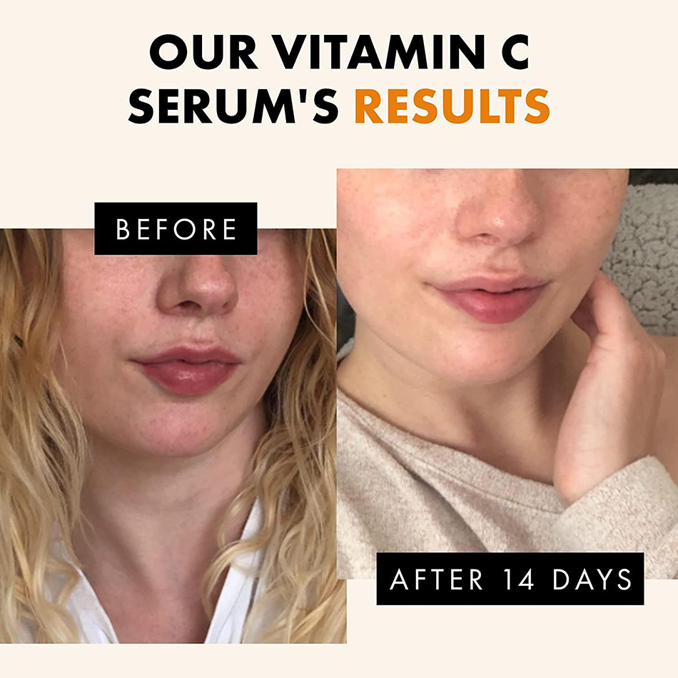 Super 120Ml Vitamine C Serum A - Vitamin C Serum recensie en prijs