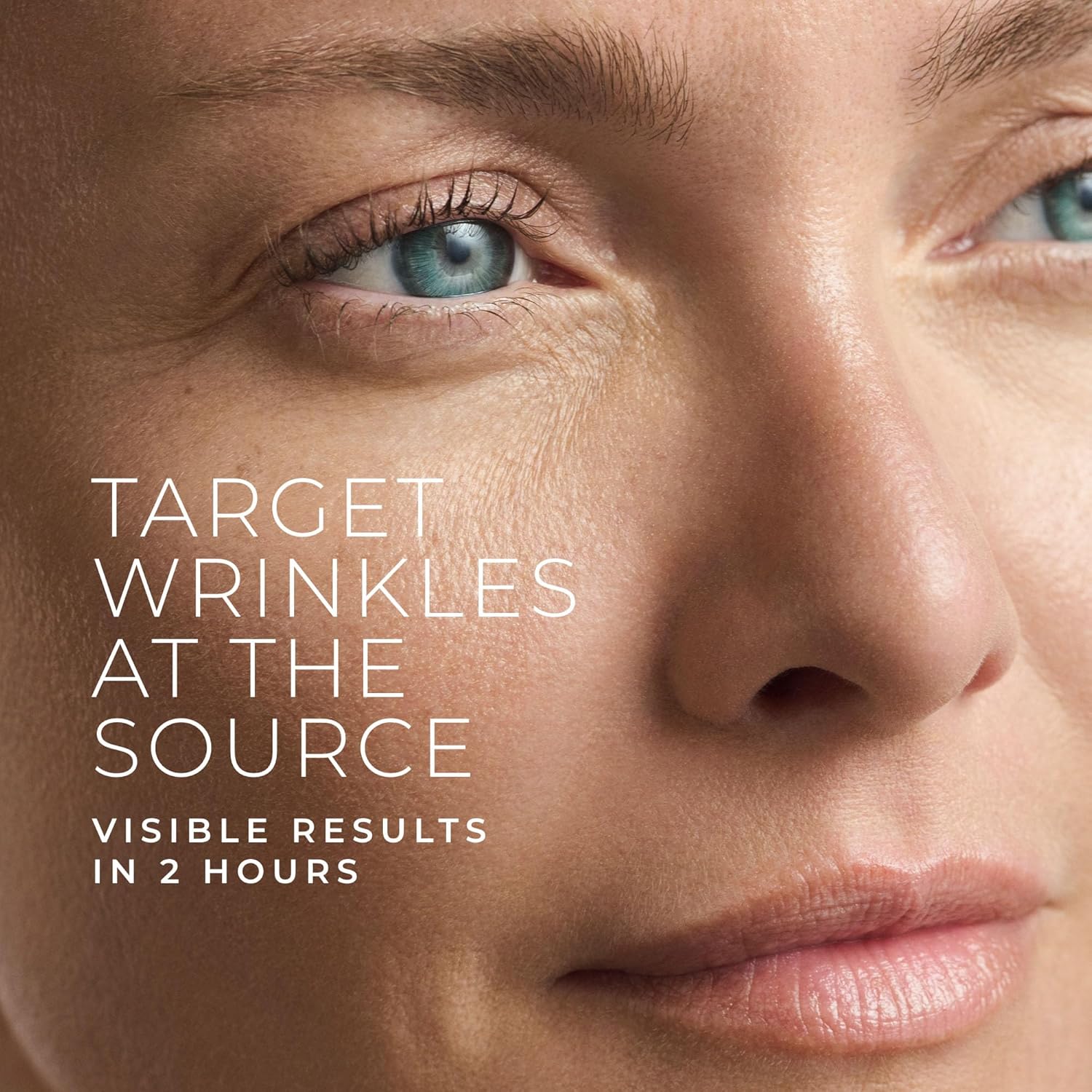 Hyaluronzuur Retinol Microneed - Face Moisturizer recensie en prijs